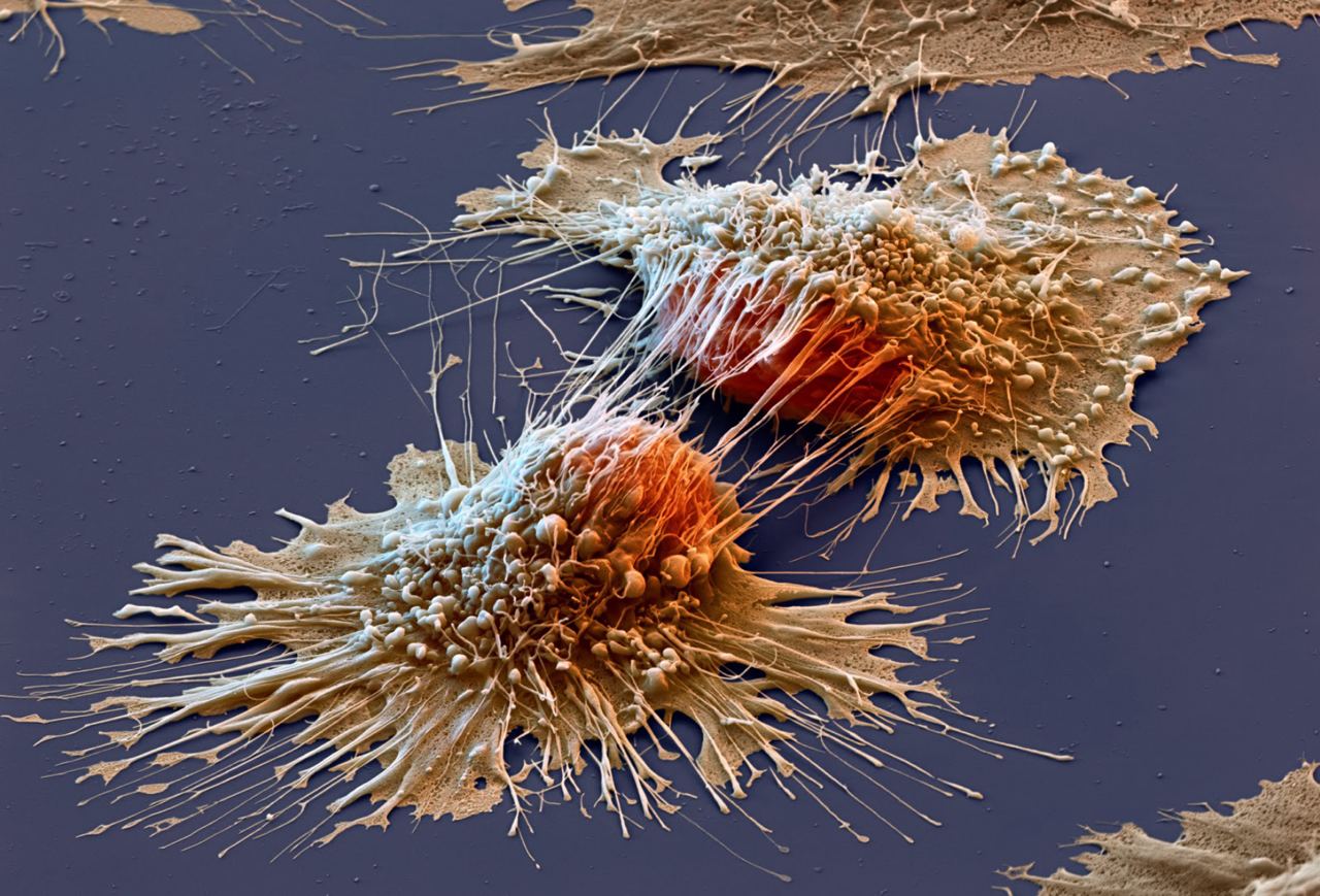 Низькі температури придушують зростання ракових клітин, – дослідження