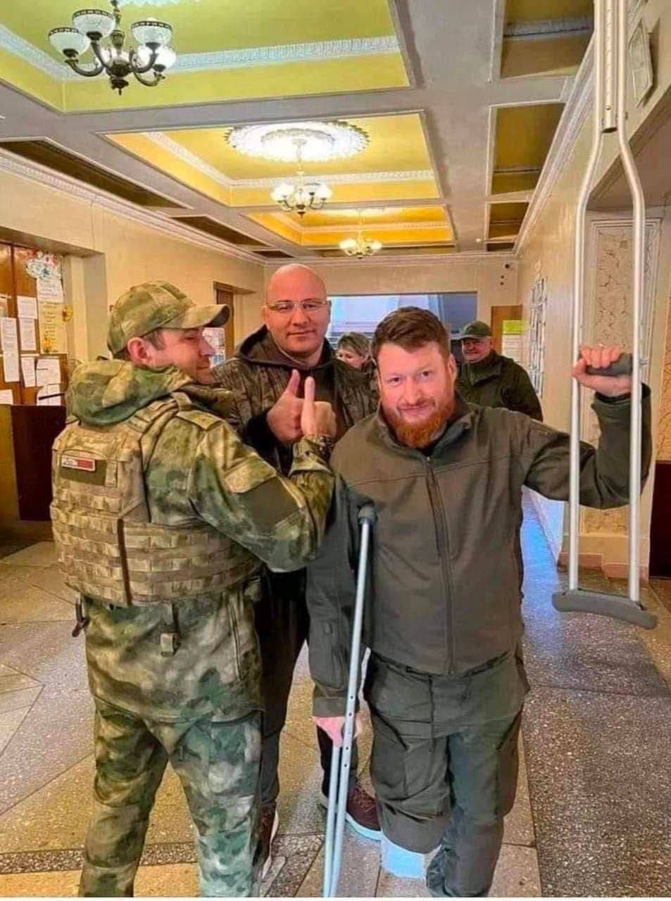 Российскому пропагандисту Семёну Пегову ампутировали ногу после того, как он наступил на мину-лепесток