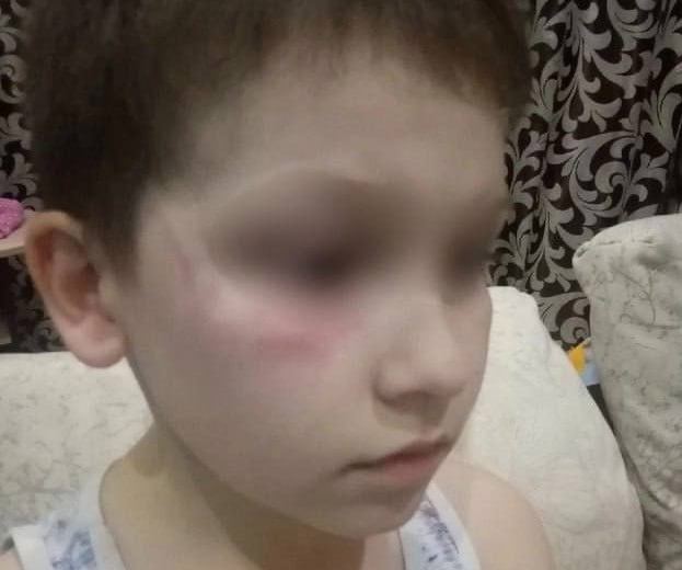 В РФ избили ребенка за сине-желтые санки