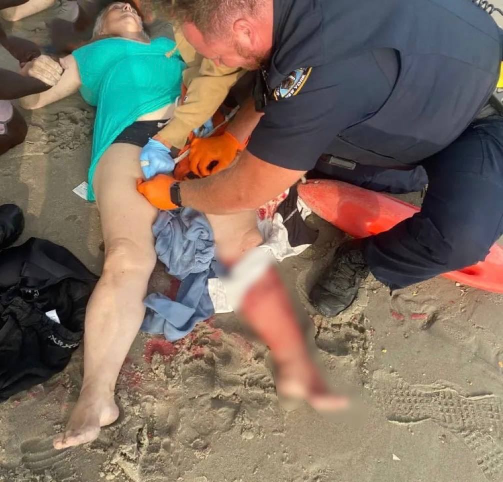 На пляже Нью-Йорка акула напала на украинскую эмигрантку из Одессы, пишет The New York Post