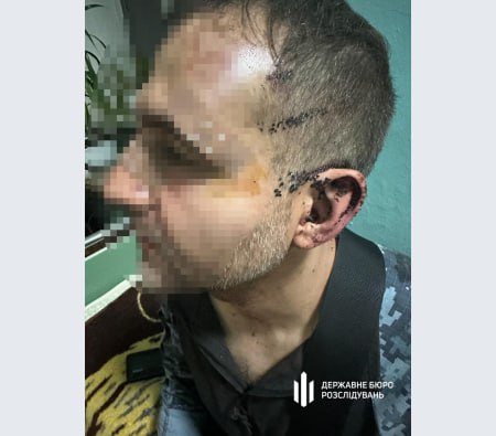 Офіцер побив солдата у військовій частині Одеської області, — ДБР